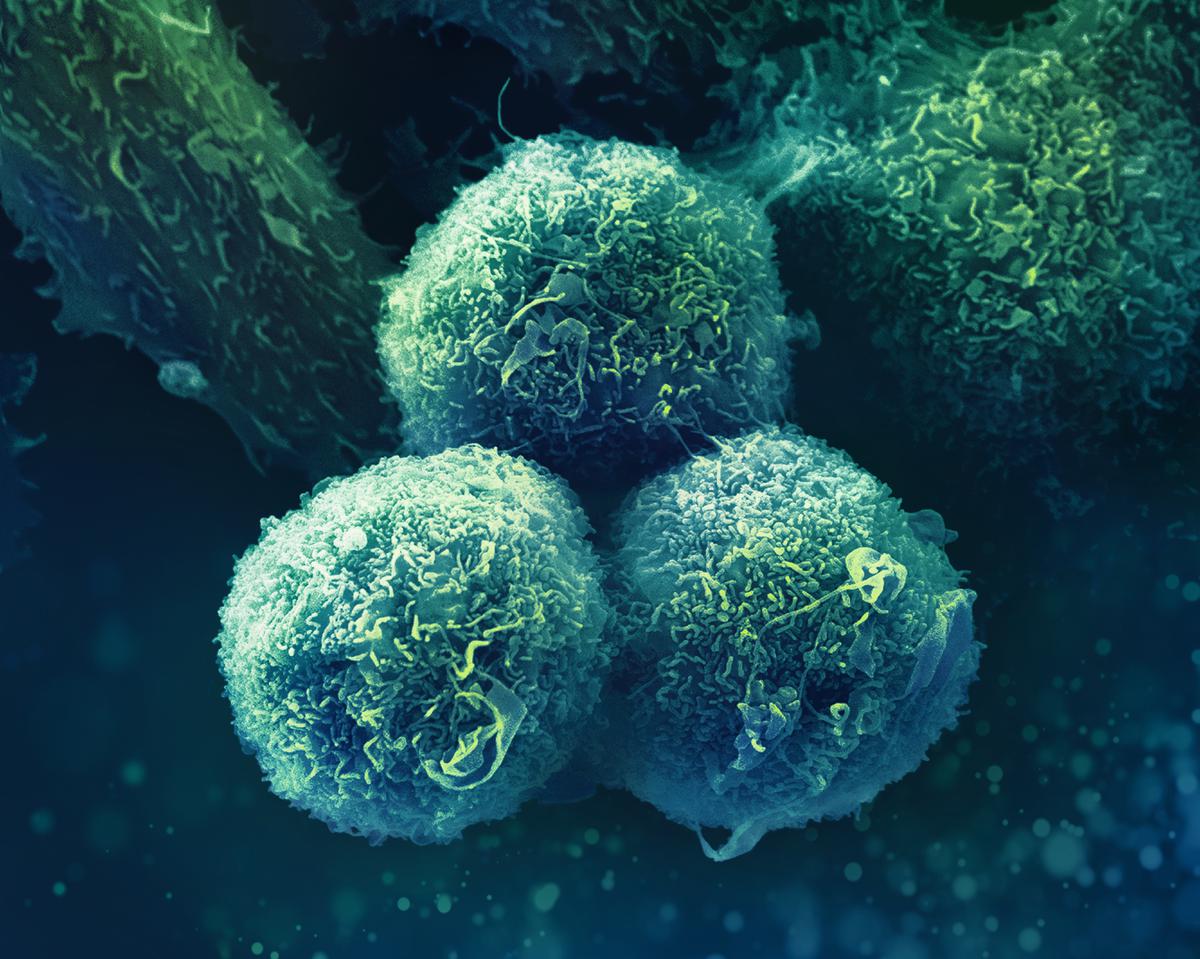 computer rendering of cancerous tissue at micro scale