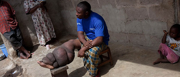 a man with a swollen leg