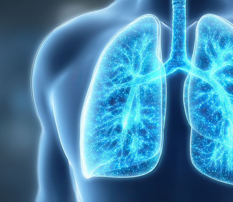 lung x-ray